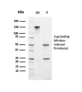 SDS-PAGE analysis of Anti-Ki67 Antibody [MKI67/2461] under non-reduced and reduced conditions; showing intact IgG and intact heavy and light chains, respectively. SDS-PAGE analysis confirms the integrity and purity of the antibody