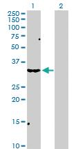 Anti-SCP2 Rabbit Polyclonal Antibody