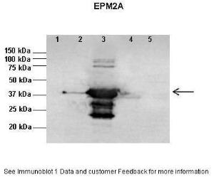 Anti-EPM2A Rabbit Polyclonal Antibody