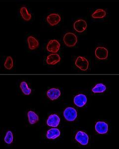 Confocal immunofluorescence analysis of HeLa cells using Anti-Lamin A Antibody [ARC5001-08] (A308800) at a dilution of 1:100 DAPI was used to stain the cell nuclei (blue)