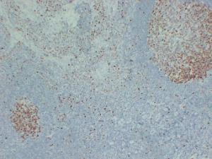 Immunohistochemical analysis of paraffin-embedded human Tonsil using Anti-MCM2 Antibody