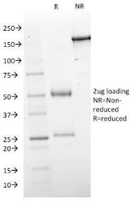 SDS-PAGE analysis of Anti-GAD67 Antibody [GAD1/2563] under non-reduced and reduced conditions; showing intact IgG and intact heavy and light chains, respectively. SDS-PAGE analysis confirms the integrity and purity of the antibody