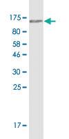 Anti-ACTN4 Mouse Monoclonal Antibody [clone: 1F8]