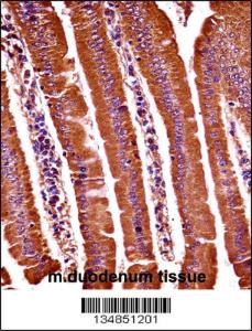 Anti-OXSR1 Rabbit Polyclonal Antibody (AP (Alkaline Phosphatase))