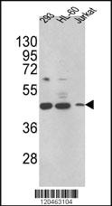 Anti-HSD17B7 Rabbit Polyclonal Antibody