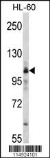 Anti-MARS Rabbit Polyclonal Antibody