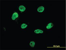 Anti-HNRNPM Mouse Monoclonal Antibody [clone: 3F7]