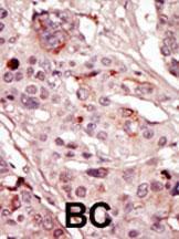 Anti-SRMS Rabbit Polyclonal Antibody (PE (Phycoerythrin))