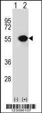 Anti-RUVBL1 Rabbit Polyclonal Antibody (Biotin)