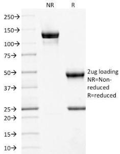 SDS-PAGE analysis of Anti-CD10 Antibody [MME/1892] under non-reduced and reduced conditions; showing intact IgG and intact heavy and light chains, respectively. SDS-PAGE analysis confirms the integrity and purity of the antibody