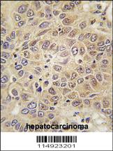 Anti-MARS Rabbit Polyclonal Antibody