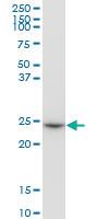 Anti-GSTO1 Mouse Polyclonal Antibody