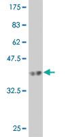 Anti-DSTYK Mouse Monoclonal Antibody [clone: 4B3]