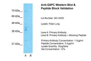 Anti-G6PC Rabbit Polyclonal Antibody