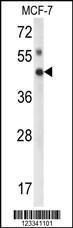 Anti-IPMK Rabbit Polyclonal Antibody (APC (Allophycocyanin))