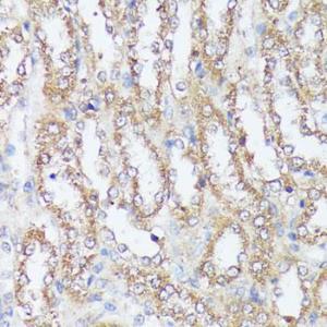 Immunohistochemistry analysis of paraffin-embedded rat kidney using Anti-MTHFD2 Antibody (A11302) at a dilution of 1:100 (40x lens) Perform microwave antigen retrieval with 10 mM PBS buffer pH 72 before commencing with IHC staining protocol