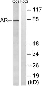 Western blot analysis of lysates from K562 cells, treated with EGF 200ng/ml 5' using Anti-Androgen Receptor Antibody The right hand lane represents a negative control, where the antibody is blocked by the immunising peptide