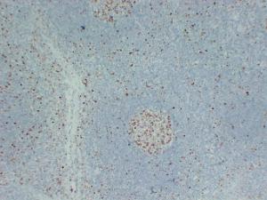 Immunohistochemical analysis of paraffin-embedded human Tonsil using Anti-MCM2 Antibody