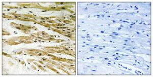 Immunohistochemical analysis of paraffin-embedded human heart tissue using Anti-DMC1 Antibody. The right hand panel represents a negative control, where the antibody was pre-incubated with the immunising peptide.