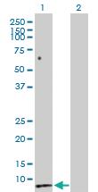 Anti-SCT Rabbit Polyclonal Antibody