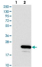 Anti-AVPI1 Rabbit Polyclonal Antibody