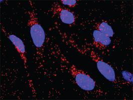 Anti-HNF4A + CTNNB1 Antibody Pair