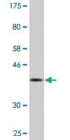 Anti-AKAP6 Mouse Monoclonal Antibody [clone: 2E8]