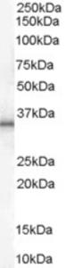 EB06994 (1 µg/ml) staining of Human Adipose lysate (35 µg protein in RIPA buffer).  Primary incubation was 1 hour.  Detected by chemiluminescence.