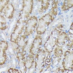 Immunohistochemistry analysis of paraffin-embedded mouse kidney using Anti-MTHFD2 Antibody (A11302) at a dilution of 1:100 (40x lens) Perform microwave antigen retrieval with 10 mM PBS buffer pH 72 before commencing with IHC staining protocol