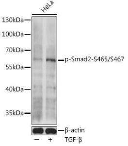 Western blot analysis of extracts of HeLa cells, using Anti-Smad2 (phospho Ser465 + Ser467) Antibody (A308803) at 1:1,000 dilutio