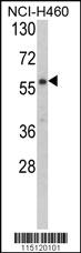 Anti-CARS2 Rabbit Polyclonal Antibody