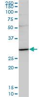 Anti-TRADD Mouse Monoclonal Antibody [clone: 3G1]