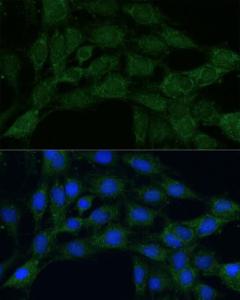 Immunofluorescence analysis of C6 cells using Anti-MTHFD2 Antibody (A11302) at a dilution of 1:100 DAPI was used to stain the cell nuclei (blue)