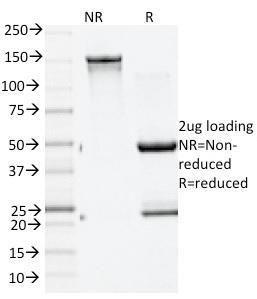 Antibody anti-GAD65 GAD21960 100 µg