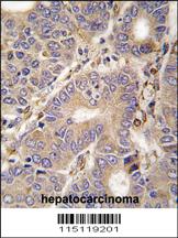 Anti-CARS2 Rabbit Polyclonal Antibody