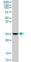 Anti-GSTO1 Mouse Polyclonal Antibody