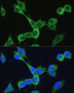 Immunofluorescence analysis of NIH-3T3 cells using Anti-MTHFD2 Antibody (A11302) at a dilution of 1:100 DAPI was used to stain the cell nuclei (blue)