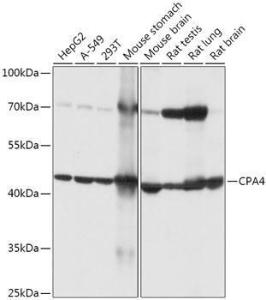 Western blot analysis of extracts of various cell lines, using Anti-CPA4 Antibody (A308805) at 1:1,000 dilution. The secondary antibody was Goat Anti-Rabbit IgG H&L Antibody (HRP) at 1:10,000 dilution.