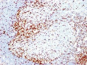 Immunohistochemical analysis of formalin-fixed, paraffin-embedded human tonsil using Anti-ZAP70 Antibody [2F3.2]