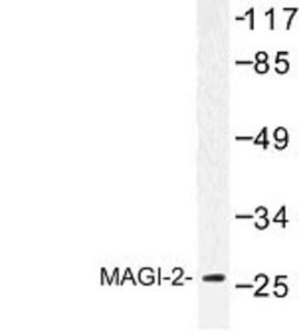 Anti-SIRT5 Rabbit Polyclonal Antibody