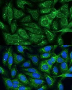 Immunofluorescence analysis of U-2 OS cells using Anti-MTHFD2 Antibody (A11302) at a dilution of 1:100 DAPI was used to stain the cell nuclei (blue)