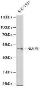 Western blot analysis of extracts of SGC-7901 cells, using Anti-NMUR1 Antibody (A308806) at 1:1000 dilution. The secondary Antibody was Goat Anti-Rabbit IgG H&L Antibody (HRP) at 1:10000 dilution. Lysates/proteins were present at 25 µg per lane