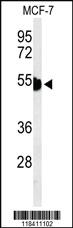 Anti-ADRBK2 Rabbit Polyclonal Antibody