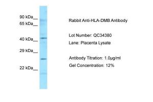 Anti-HLA-DMB Rabbit Polyclonal Antibody