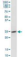 Anti-GSTO1 Mouse Polyclonal Antibody