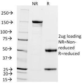 SDS-PAGE analysis of Anti-ZAP70 Antibody [2F3.2] under non-reduced and reduced conditions; showing intact IgG and intact heavy and light chains, respectively. SDS-PAGE analysis confirms the integrity and purity of the antibody.