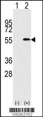 Anti-NUP50 Rabbit Polyclonal Antibody