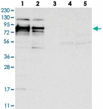 Anti-HS6ST2 Rabbit Polyclonal Antibody