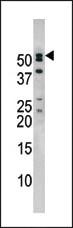 Anti-NUP50 Rabbit Polyclonal Antibody