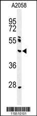 Anti-NEIL1 Rabbit Polyclonal Antibody